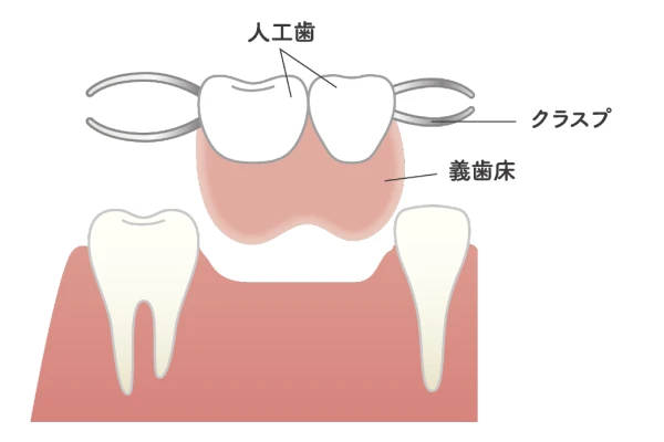 入れ歯について